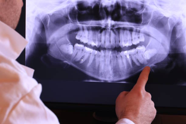 Best Emergency Treatment for Toothache in Douglass, KS