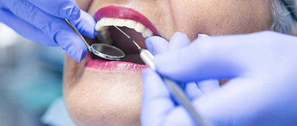 Best Emergency Tooth Extraction in Douglass, KS